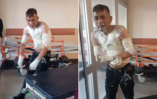 Engelli vatandaşı benzin döküp yakan vicdansıza verilen ceza belli oldu
