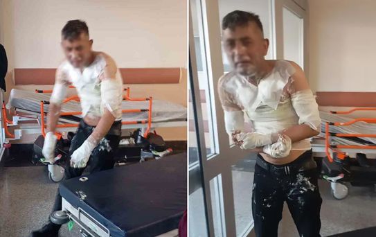 Engelli vatandaşı benzin döküp yakan vicdansıza verilen ceza belli oldu