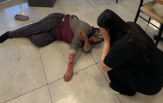 Saldırgan köpek kadının kolunu kopardı