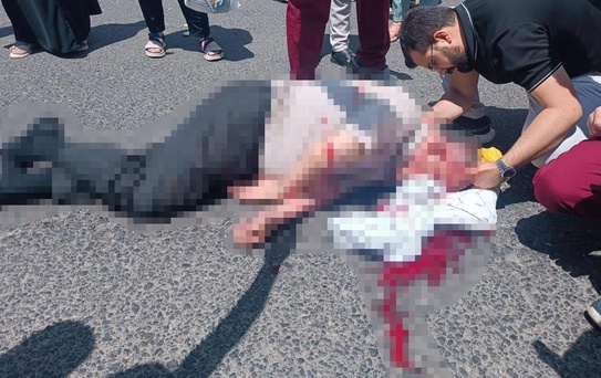 Üniversite kampüsünde korkunç kaza
