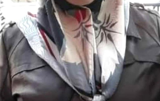 Yangında Yaralanan Kadın Hayatını Kaybetti