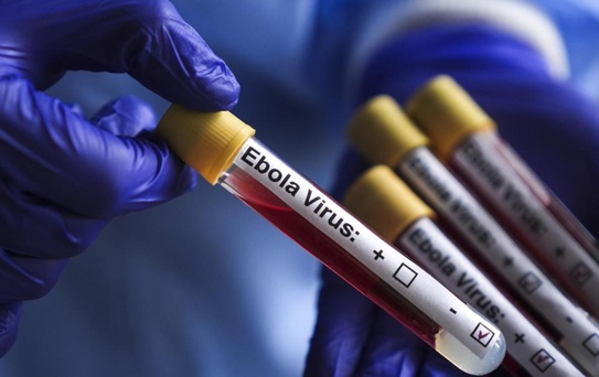 Kongo'da ebola salgını: 1155 vaka, 304 ölüm