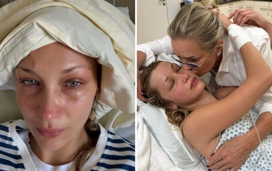 Hastalıkla mücadele eden Bella Hadid: Artık nefes bile alamıyorum