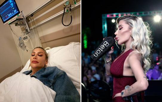 İrem Derici’nin çene görüntüsü şaşırttı! Herkes dolgu sandı ama gerçek ortaya çıktı
