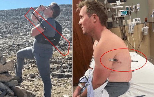 Mucize kurtuluş! Bu halde 16 kilometre yürüdü