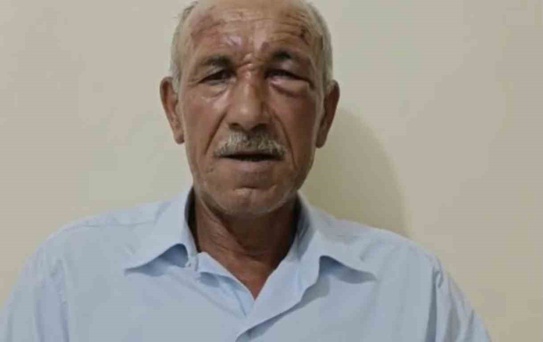 Muhtar Saldırıya Uğradı, 2 Şüpheli Tutuklandı