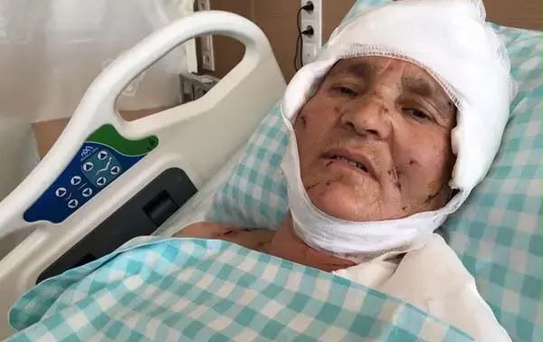 Yaşlı kadın evinin önünde dehşeti yaşadı: Yargıtay'dan köpek saldırısında emsal karar