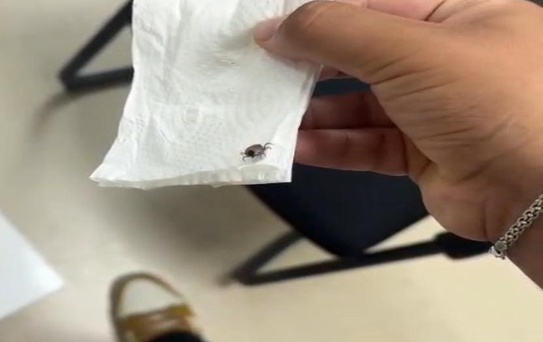 Bir aylık ağrının nedeni dehşete düşürdü! 5 yaşındaki çocuğun kulağından canlı çıkarıldı