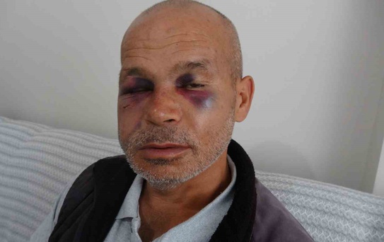 Kozan'da engelli adamı darbeden şüpheli gözaltına alındıktan sonra serbest bırakıldı
