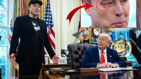 Elon Muskın gözüne ne oldu? Basın toplantısının önüne geçen fotoğraf
