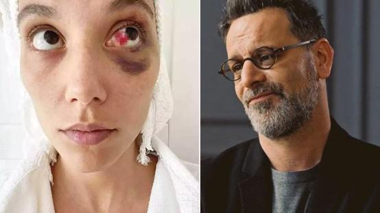 Ozan Güvene Kasten Yaralama Suçundan Hapis Cezası Verildi