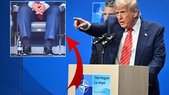 Bacaklarındaki şişlik dikkat çekmişti! Beyaz Saray Trumpın yakalandığı hastalığı açıkladı