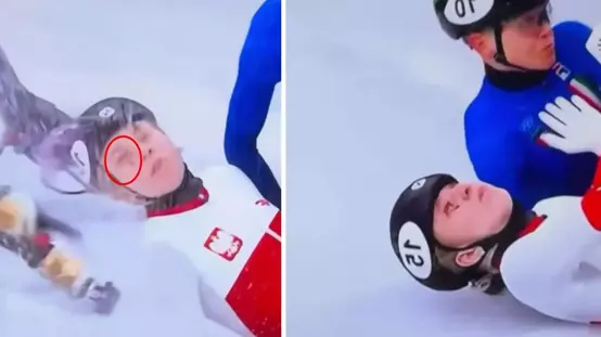 Kış Olimpiyatlarında korku dolu anlar! Paten bıçağı yüzünü kesti, az kalsın kör kalacaktı