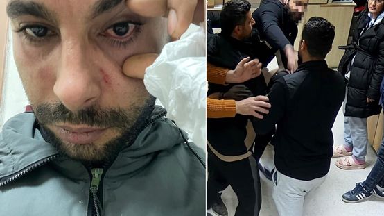 Hastasına yumruk atan doktora dava
