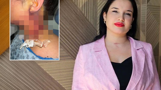Güzelleşmek isterken hayatından oluyordu 