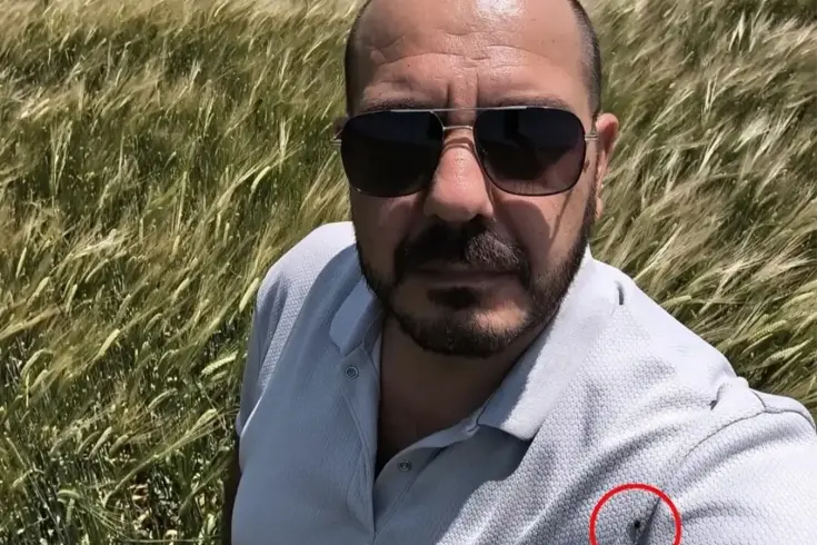 Selfi çekerken tişörtünde çok sayıda kene olduğunu fark etti