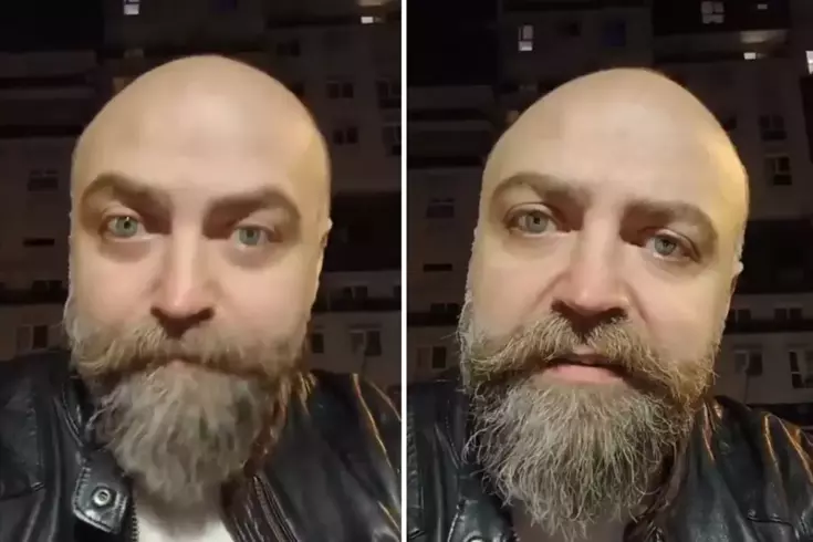 Saçsız adam isyan etti Berbere ödediği ücret öyle böyle değil