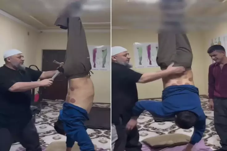 Tedavi değil işkence Ayaklarından tavana asıp çekiç ve kazıkla...