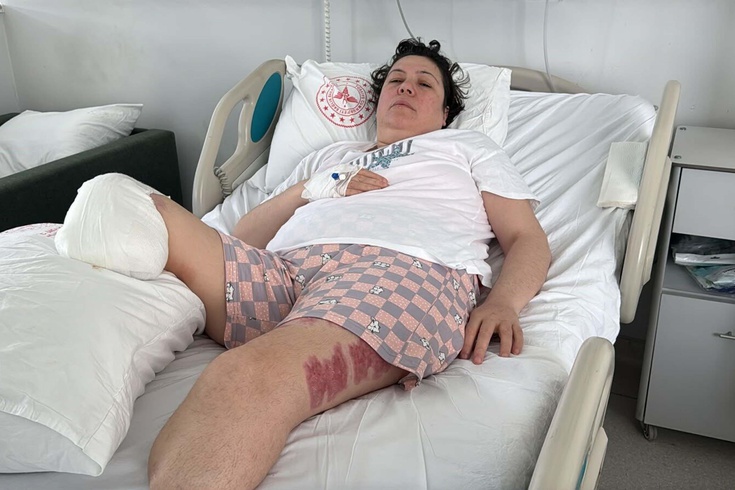 Eşini vurup iki bacağının kesilmesine neden olmuştu: Sanıktan mahkemede özür