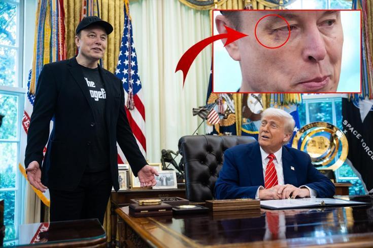 Elon Musk’ın gözüne ne oldu Basın toplantısının önüne geçen fotoğraf
