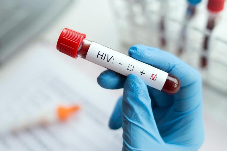 HIV tedavisinde devrim niteliğinde adım