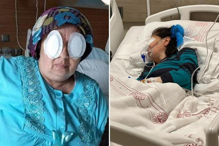 Şizofreni hastası, yatalak hastanın gözlerini oydu İlk vukuatı değil