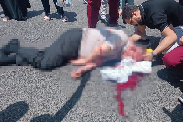 Üniversite kampüsünde korkunç kaza