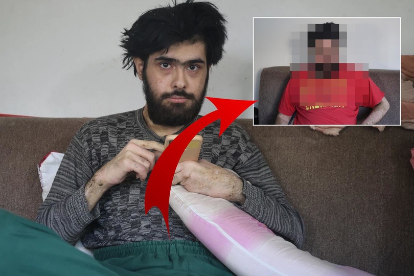 3 ay tedavi gördü ama olmadı Barış Özbay eski hayatına geri döndü