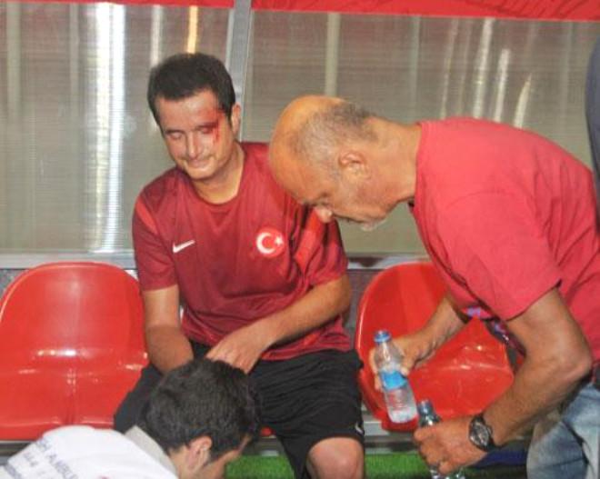 Acun’un Korku Dolu Anları Son Dakika