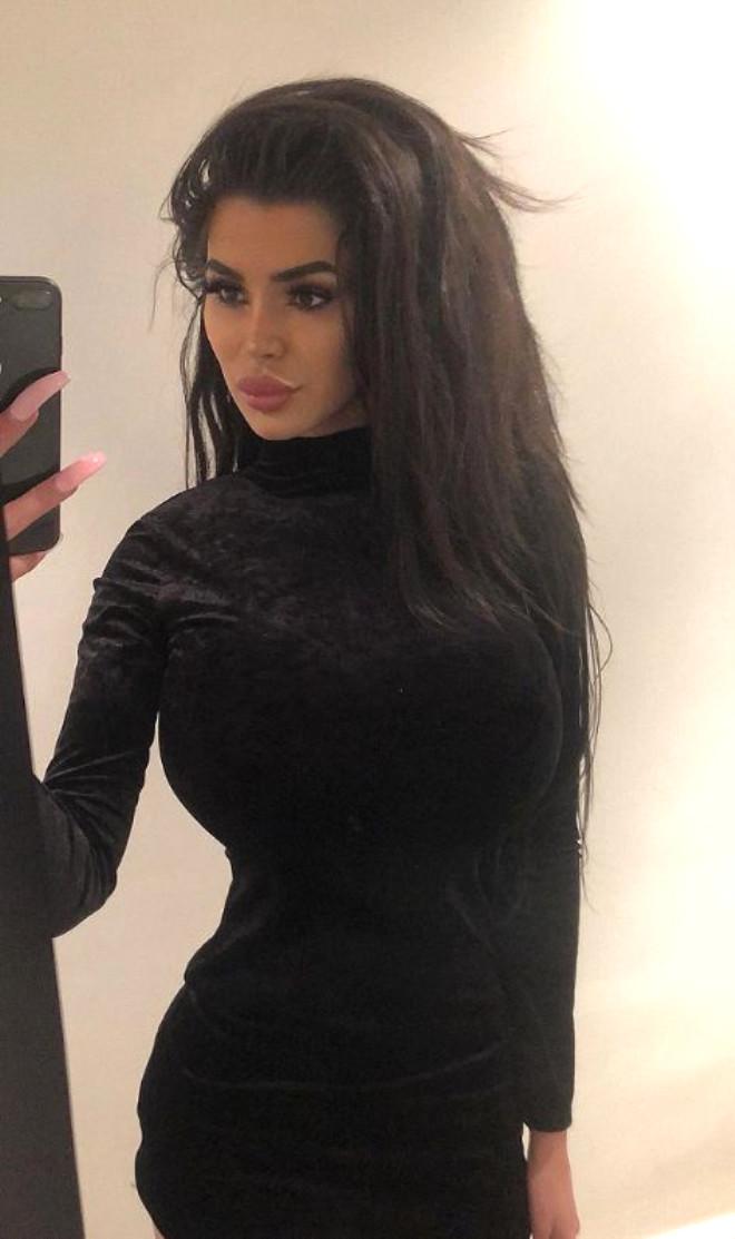 Kim Kardashian’a Benzemek İsteyen Trans Gencin Son Hali Şoke Etti Son