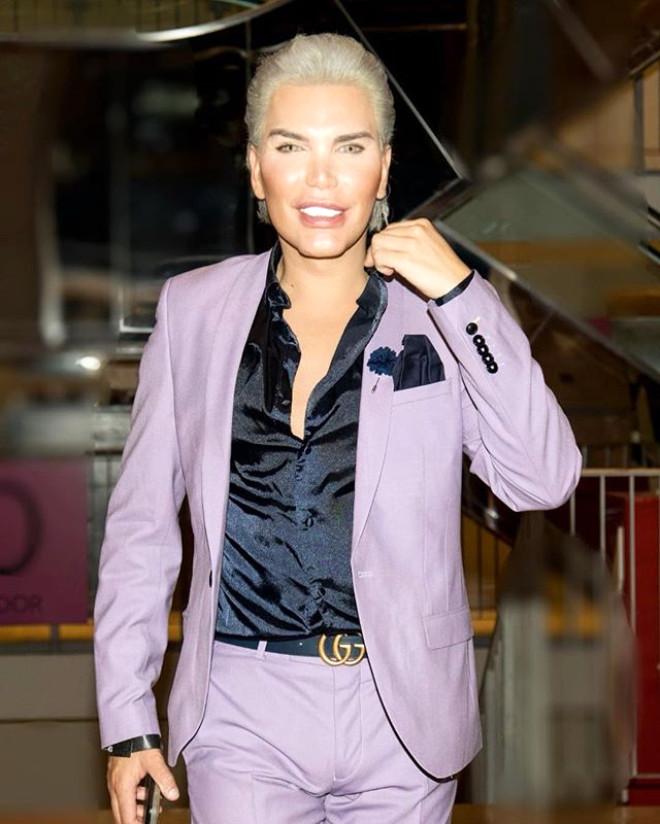 Rodrigo Alves, Oyuncak Bebek Ken’e Benzemek İçin Yeniden Bıçak Altına