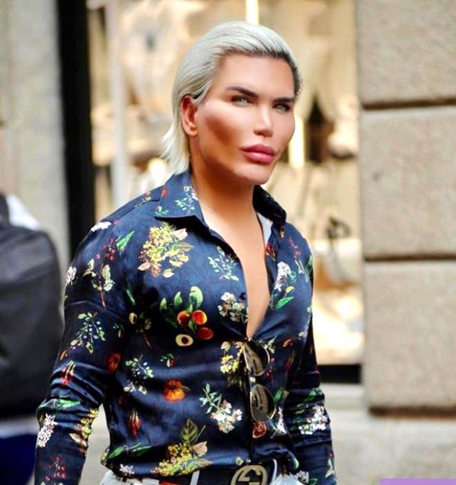 Rodrigo Alves, Oyuncak Bebek Ken’e Benzemek İçin Yeniden Bıçak Altına