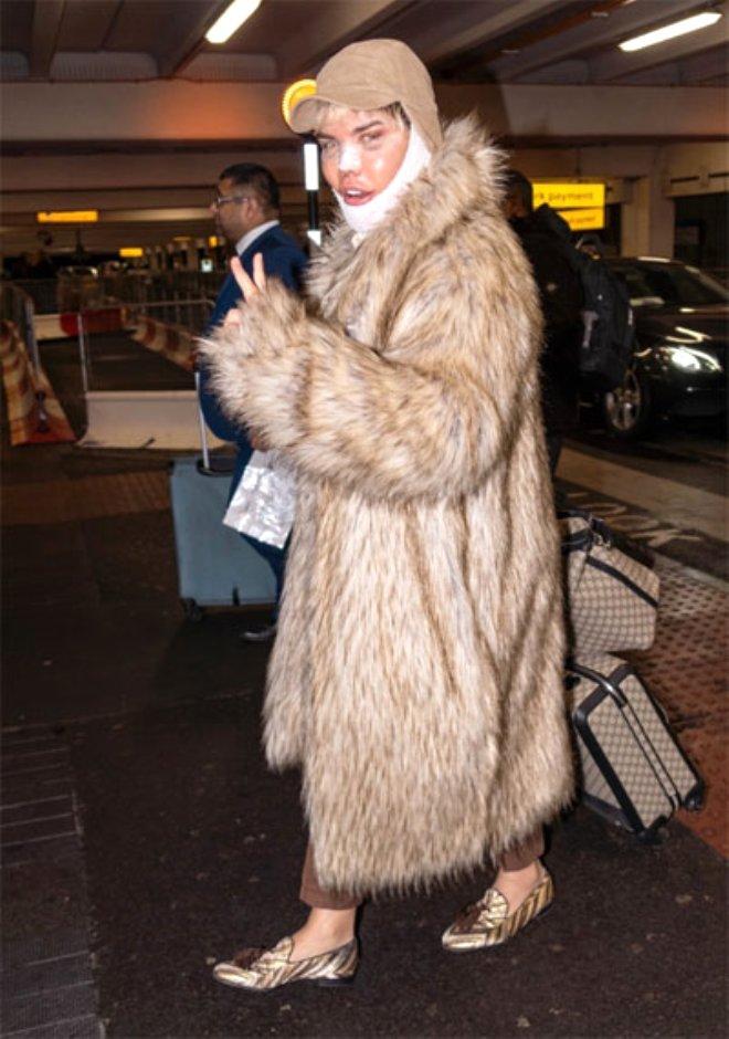 Estetik Bağımlısı Ken Bebek’in Son Hali Korkuttu Son