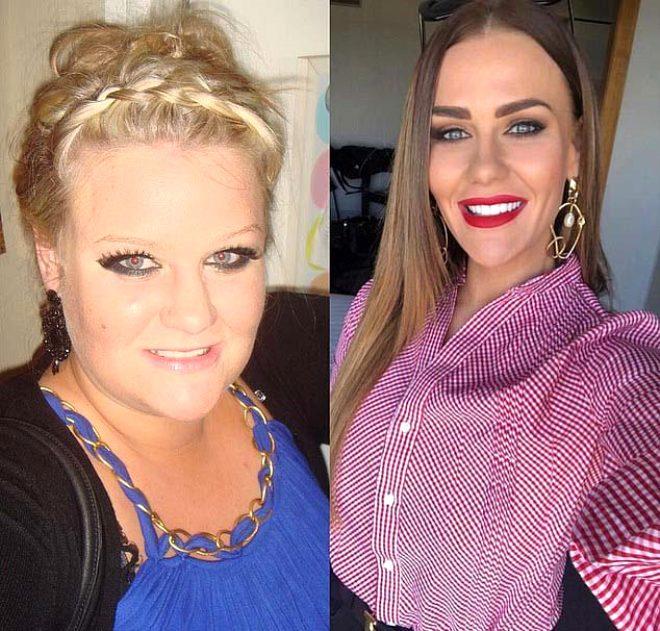 Fazla kiloları yüzünden sokağa bile çıkamıyordu 90 kilo veren fenomenin
