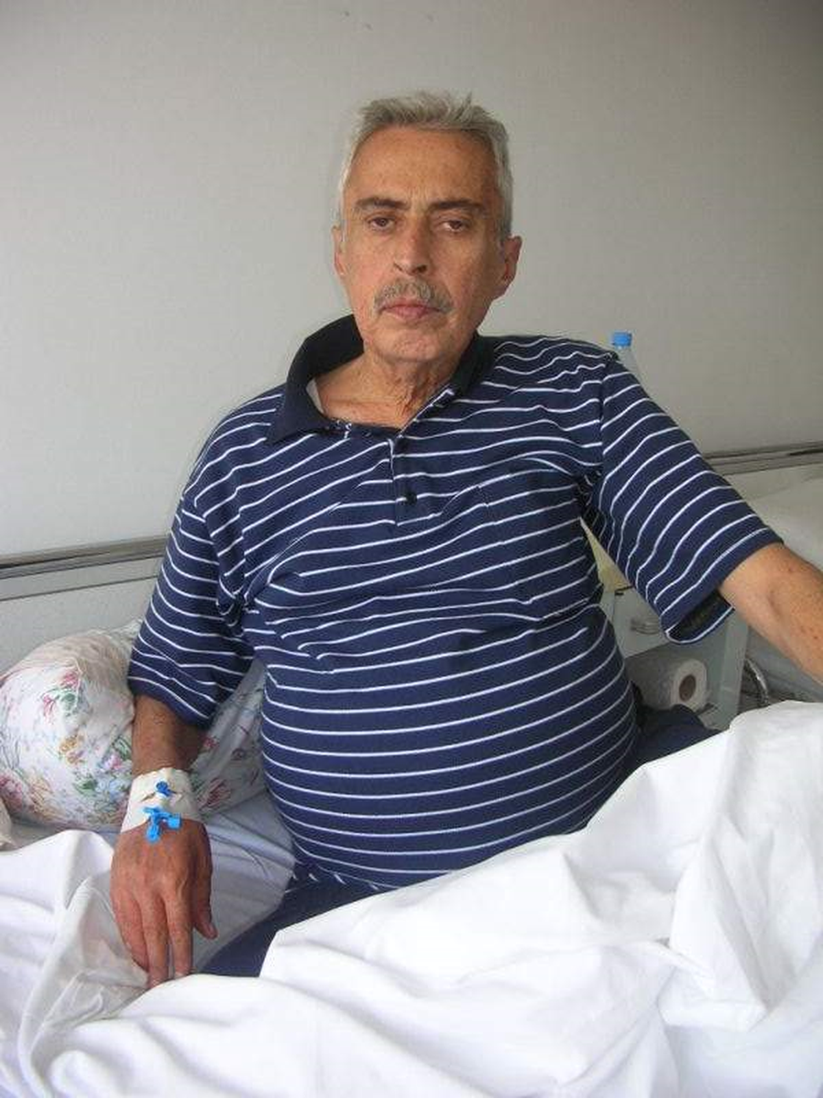 Baba- Oğul Aynı Karaciğeri Paylaştı