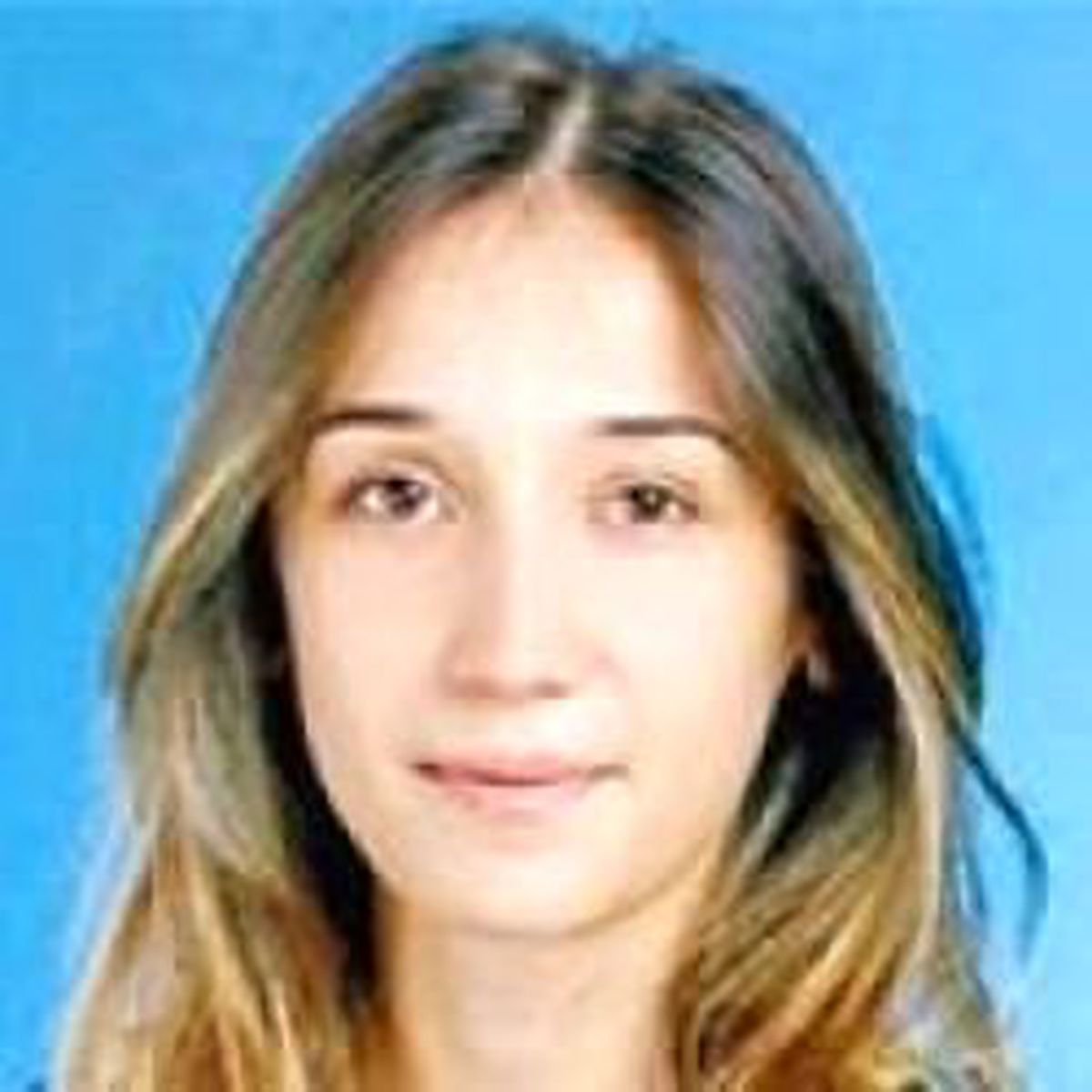 İşletme Müdürü İşbaşında Yandı