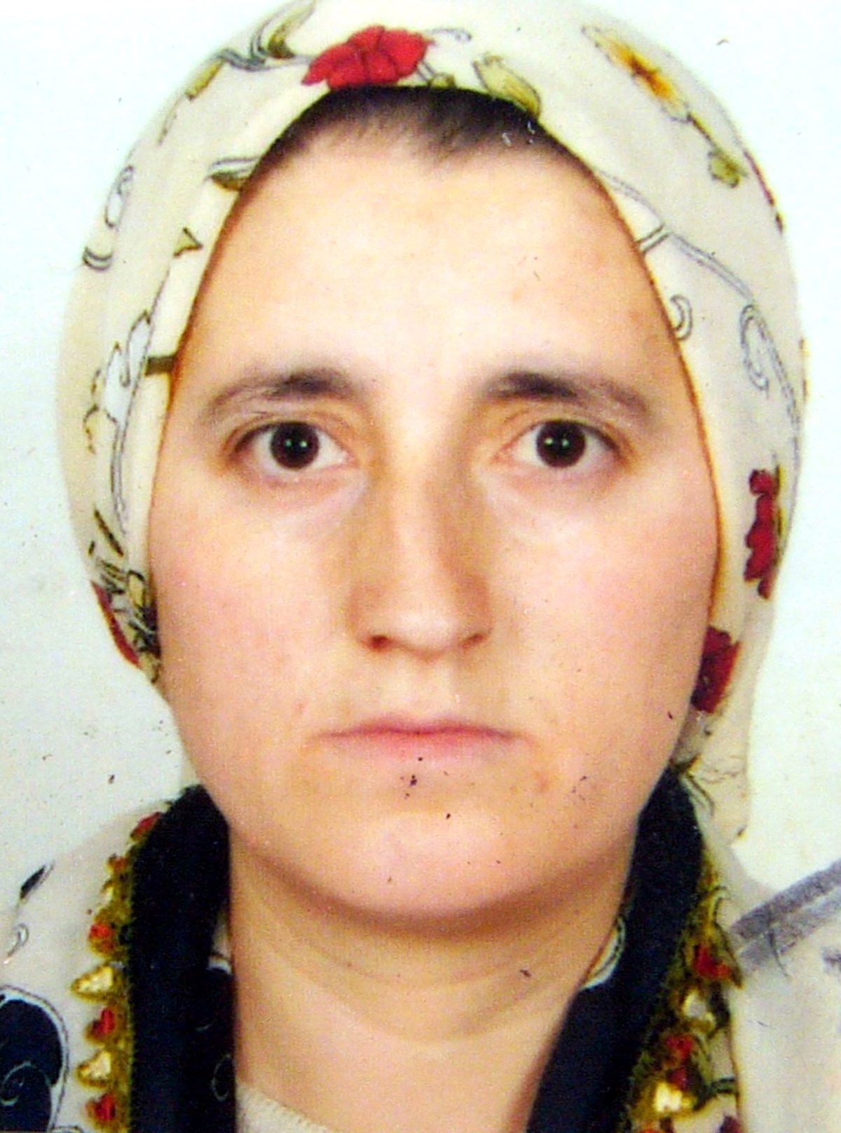 Karısının Gözüne Tekme Atıp Hastanelik Etti