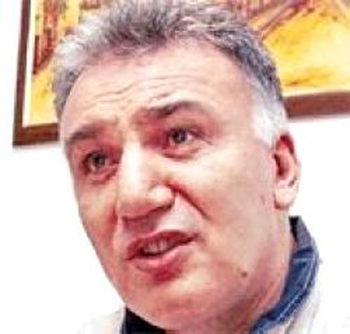Karaciğer Nakledildi
