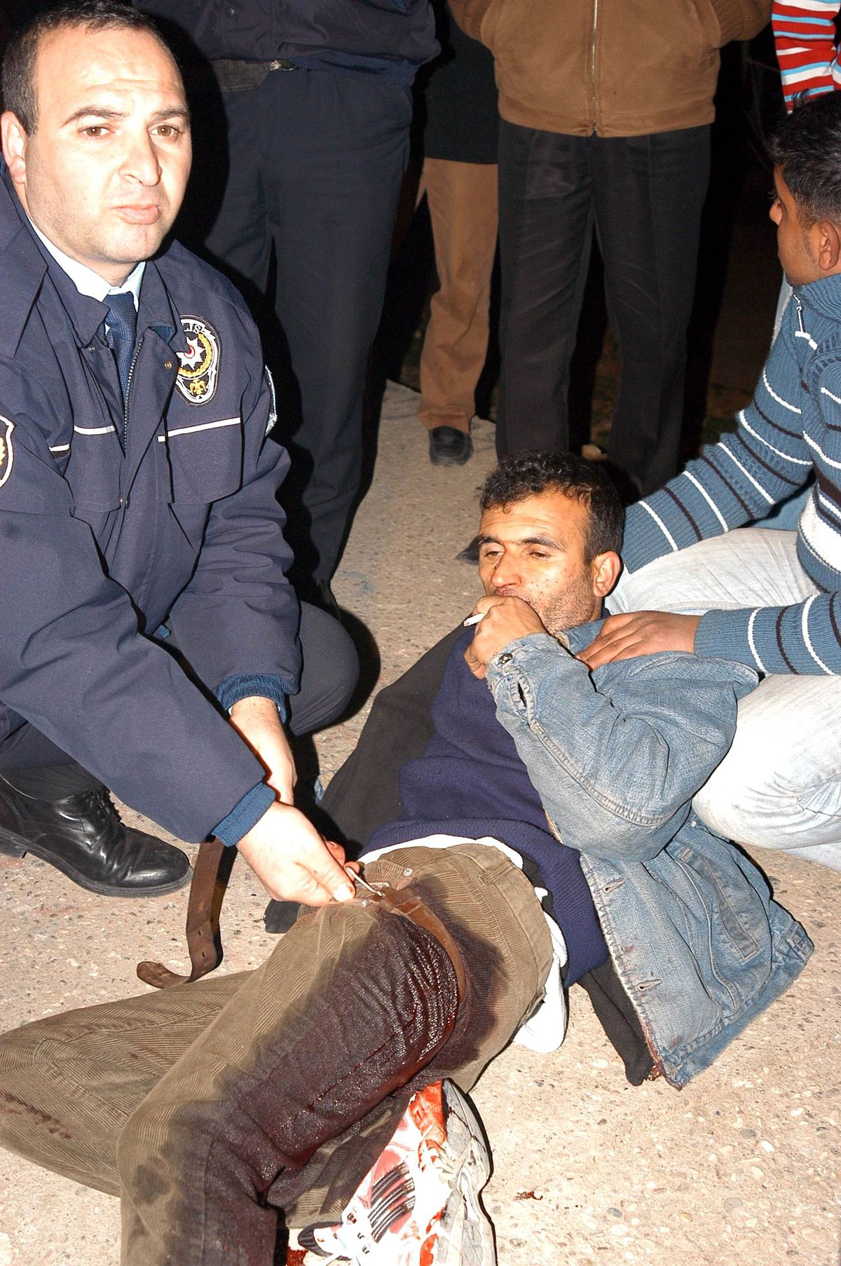 Sigara İçerek Ambulans Bekledi