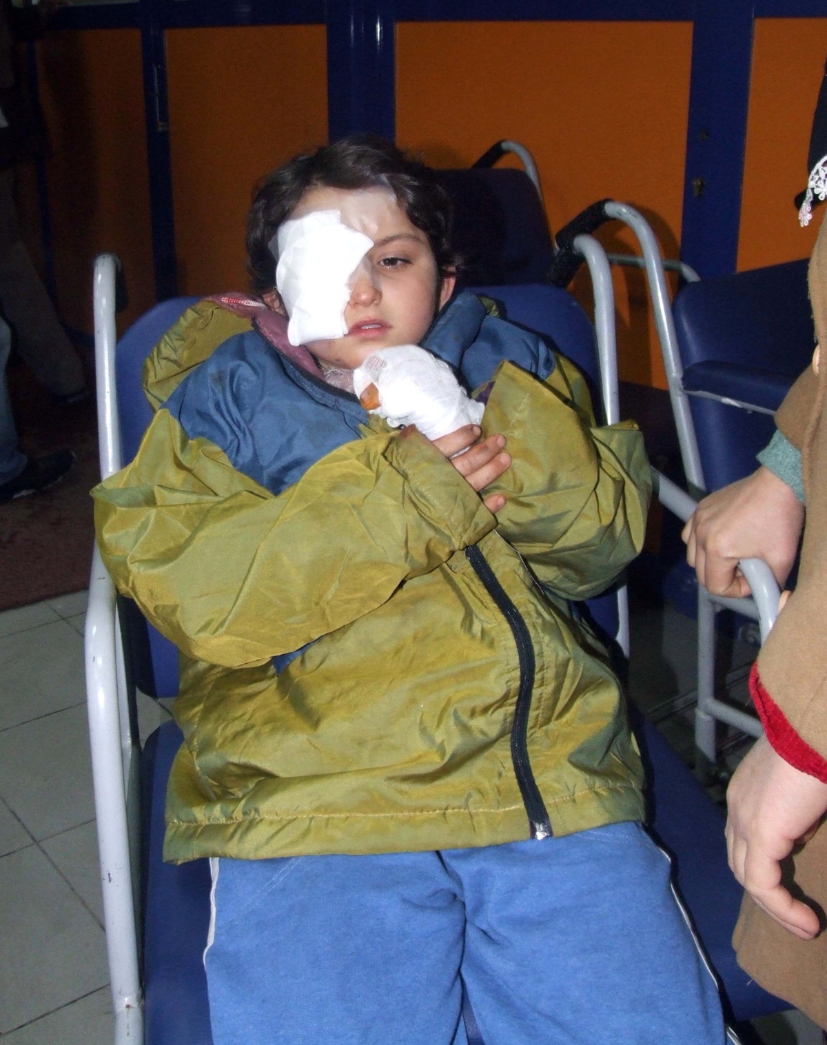 Elinde Maytap Patlayan Çocuk Yaralandı