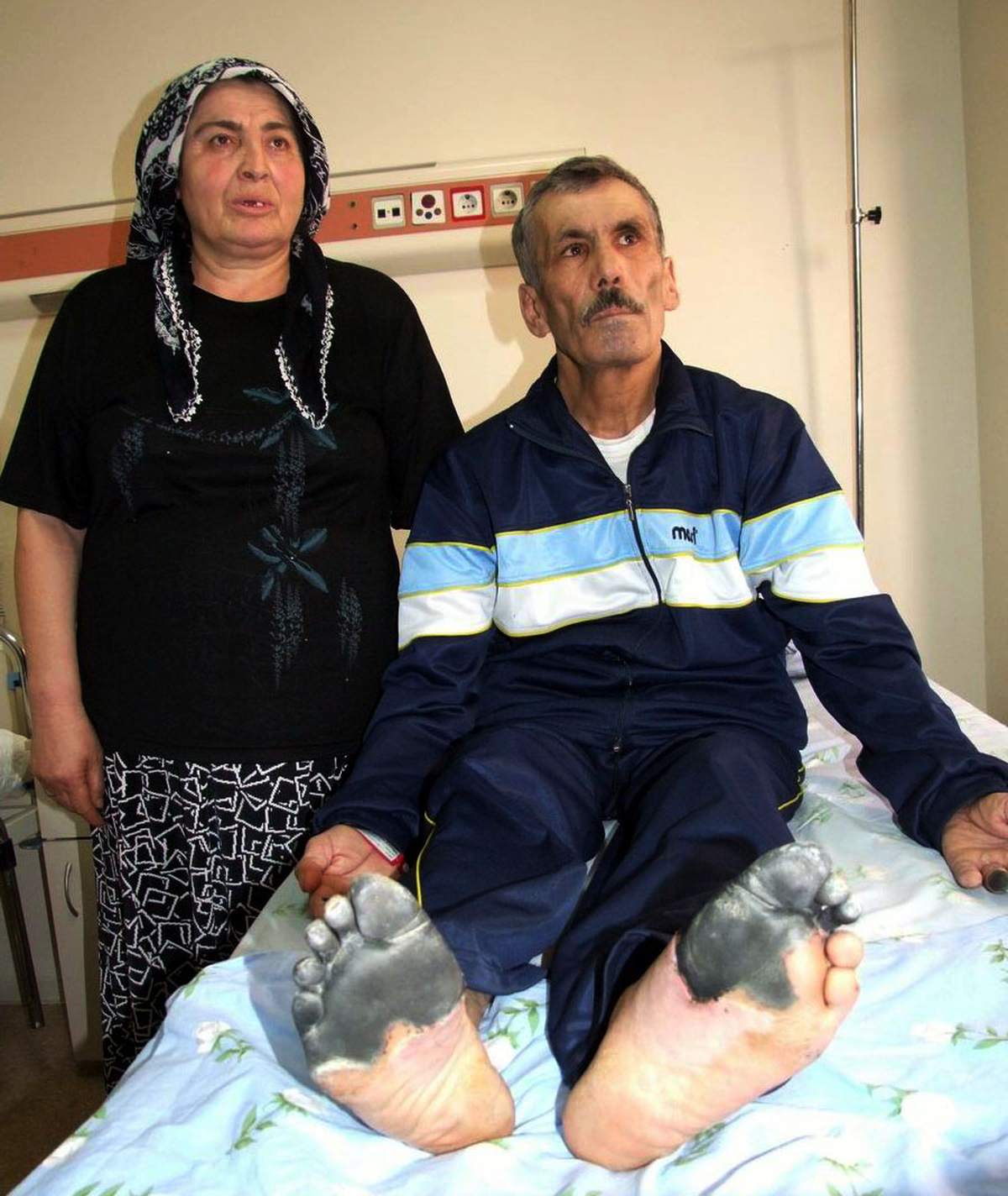 30 Yıldır İçtiği Sigara Hayatını Kararttı