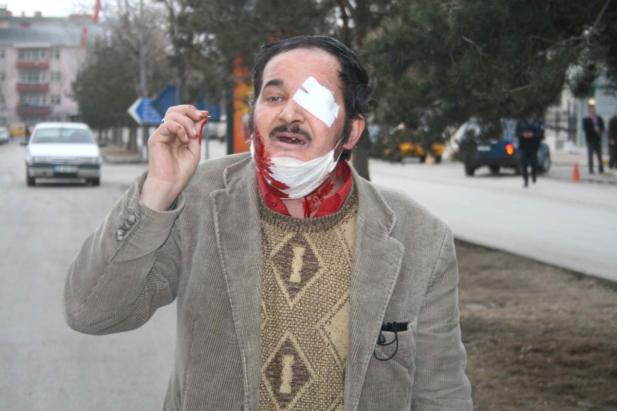 Bunalıma Giren Şahıs Erzurum Valiliği Önünde Kendini Doğradı