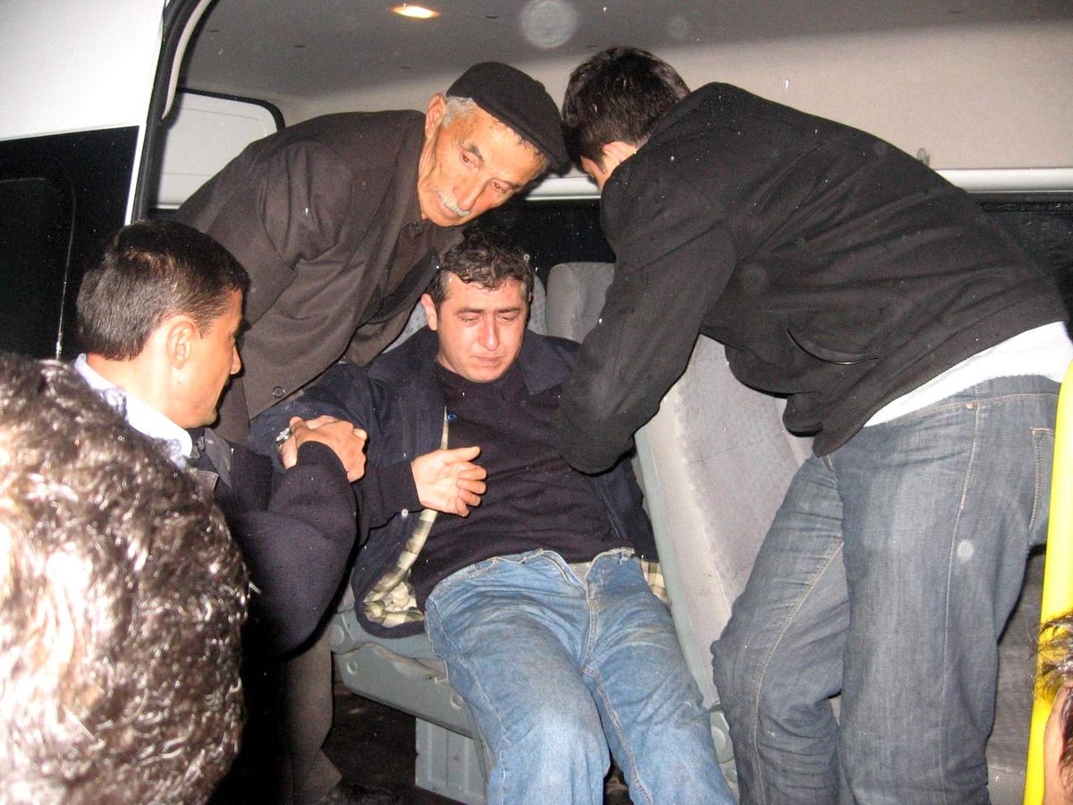 Faciaya Kıl Payı