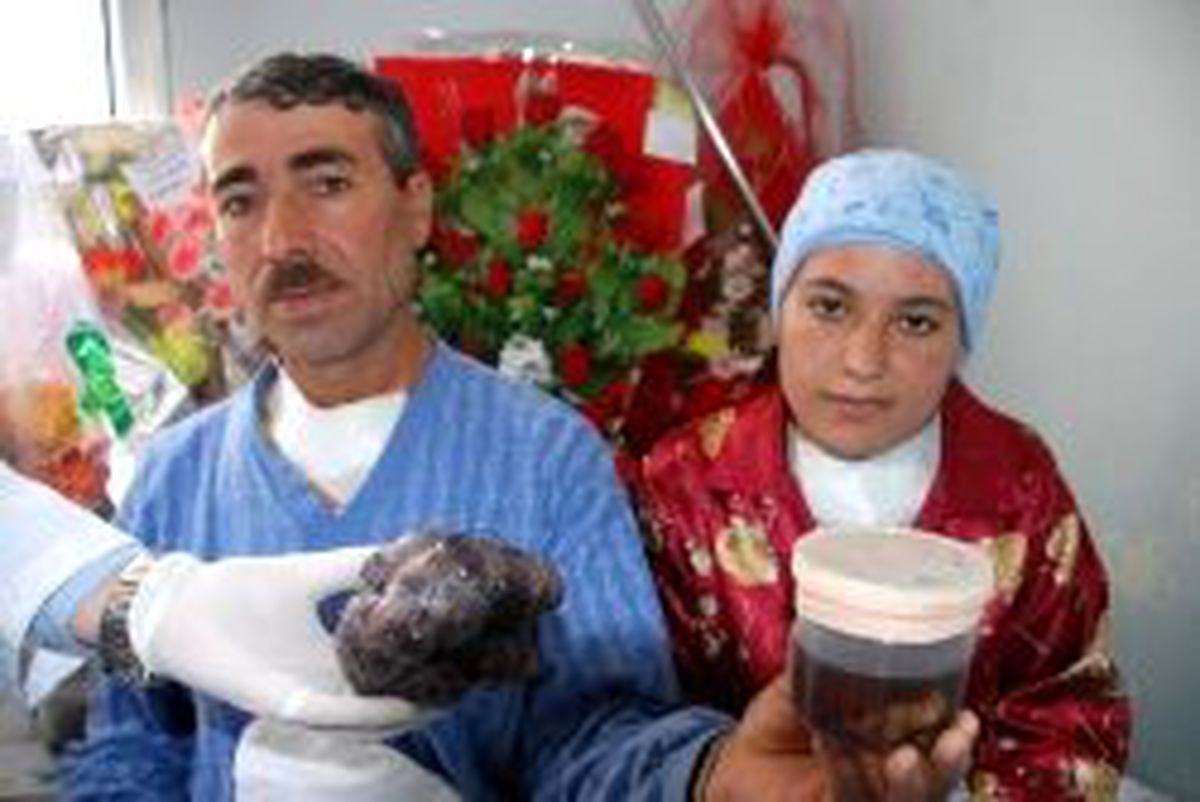 Muş'ta İlginç Guatr Ameliyatı