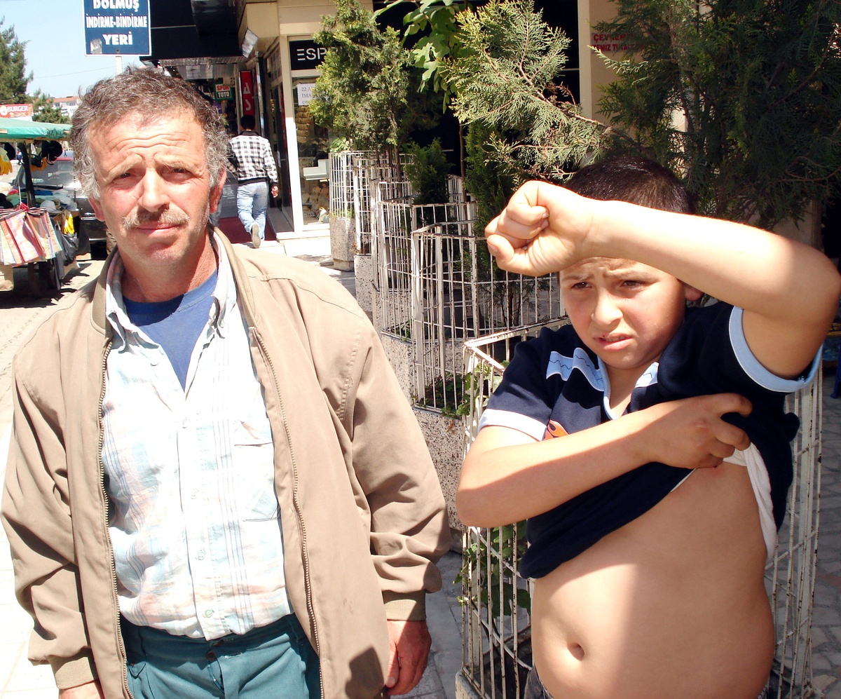 13 Yaşındaki Çocuğu Kene Isırdı