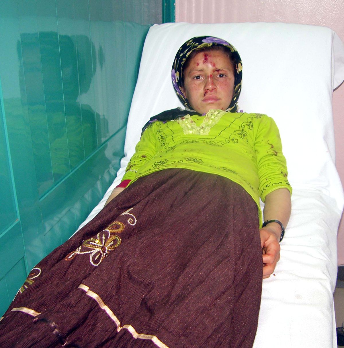 Samsun'da Traktör Devrildi: 6 Yaralı