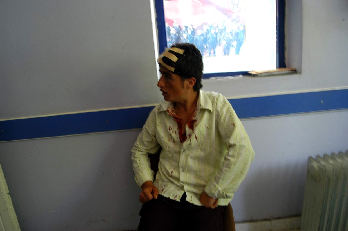 Öğrenci Kavgası Kanlı Bitti: 3 Yaralı