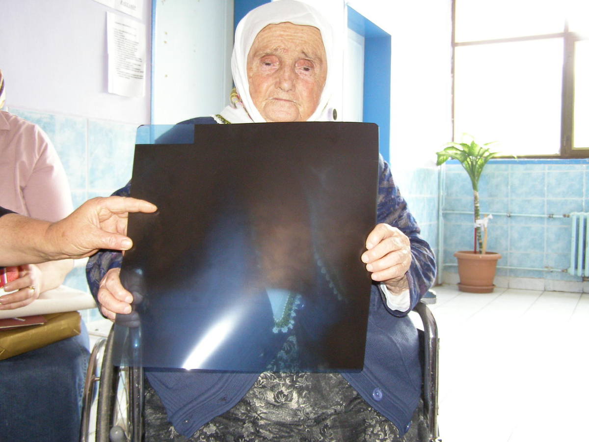 83 Yaşındaki Şadiye Nine İlk Defa Doktora Gitti