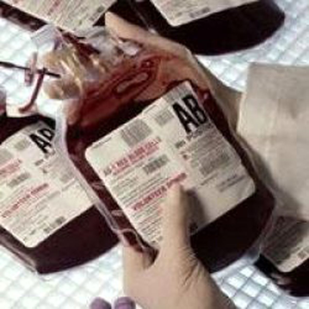 Skandal: Bebeğe AIDS'li Kan!