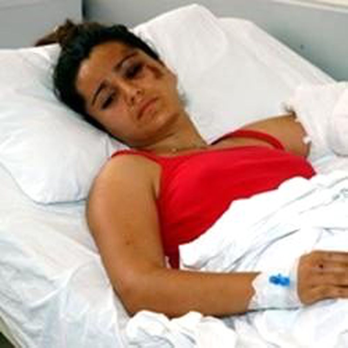 Tesadüfler ve Şans Sevim'in Kolunu Kurtardı